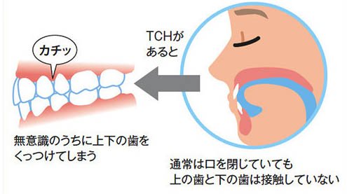 飯田橋の歯医者、飯田橋サンシャイン歯科の顎関節症治療